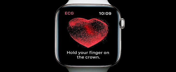 Apple Watch: ECG